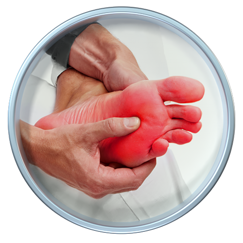 Neuropathy Pain Relief